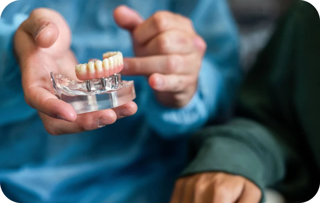 all on solution edentement villeneuve d ascq all on solution edentement villeneuve d ascq All on 4 / All on 6 Chirurgiens-dentistes | Villeneuve d’Ascq près de Lille