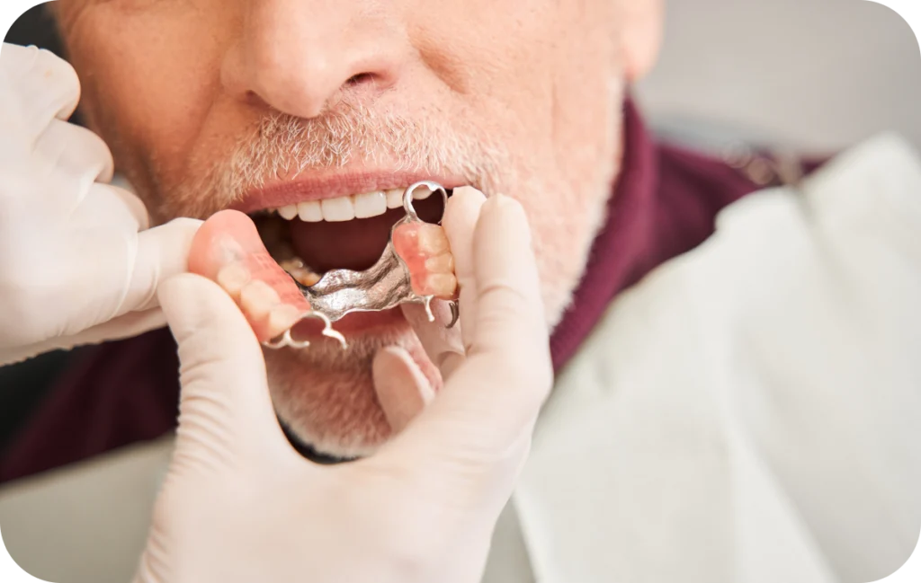 preservation alveolaire support implantaire villeneuve d ascq Prothèses dentaires Chirurgiens-dentistes | Villeneuve d’Ascq près de Lille
