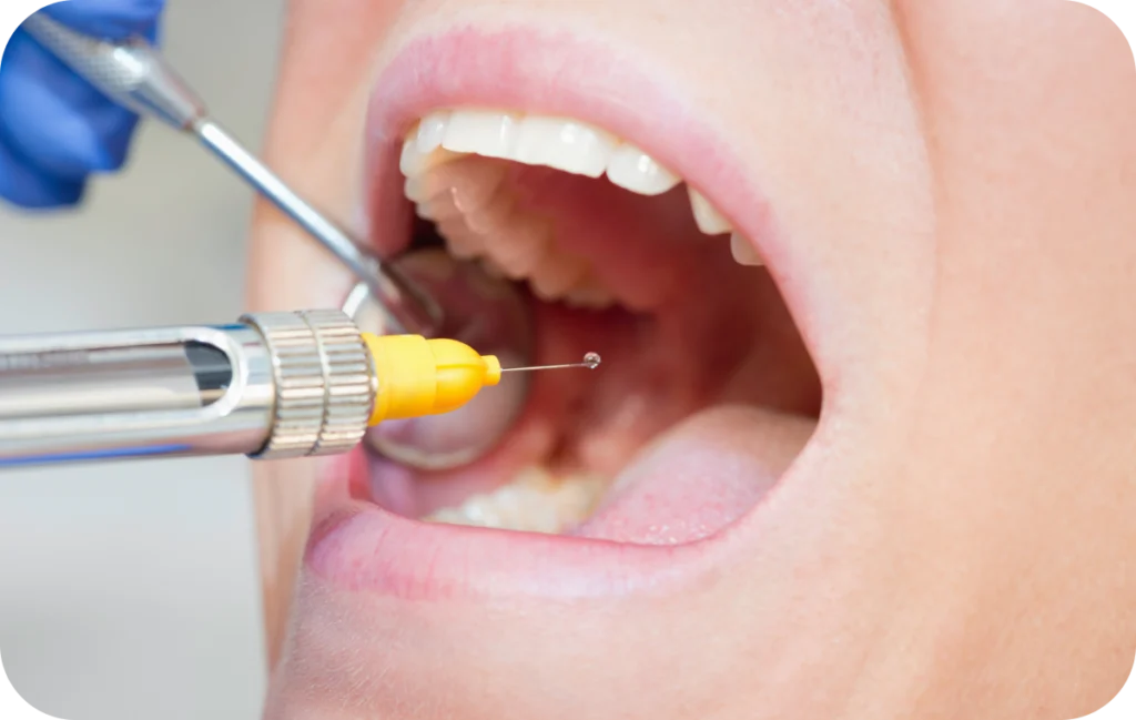 anesthesie dentaire villeneuve d ascq anesthesie dentaire villeneuve d ascq Conseils pré-opératoires Chirurgiens-dentistes | Villeneuve d’Ascq près de Lille