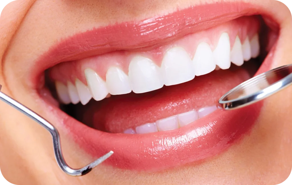 dentisterie esthetique correction defauts villeneuve d ascq dentisterie esthetique correction defauts villeneuve d ascq Soins des gencives Chirurgiens-dentistes | Villeneuve d’Ascq près de Lille