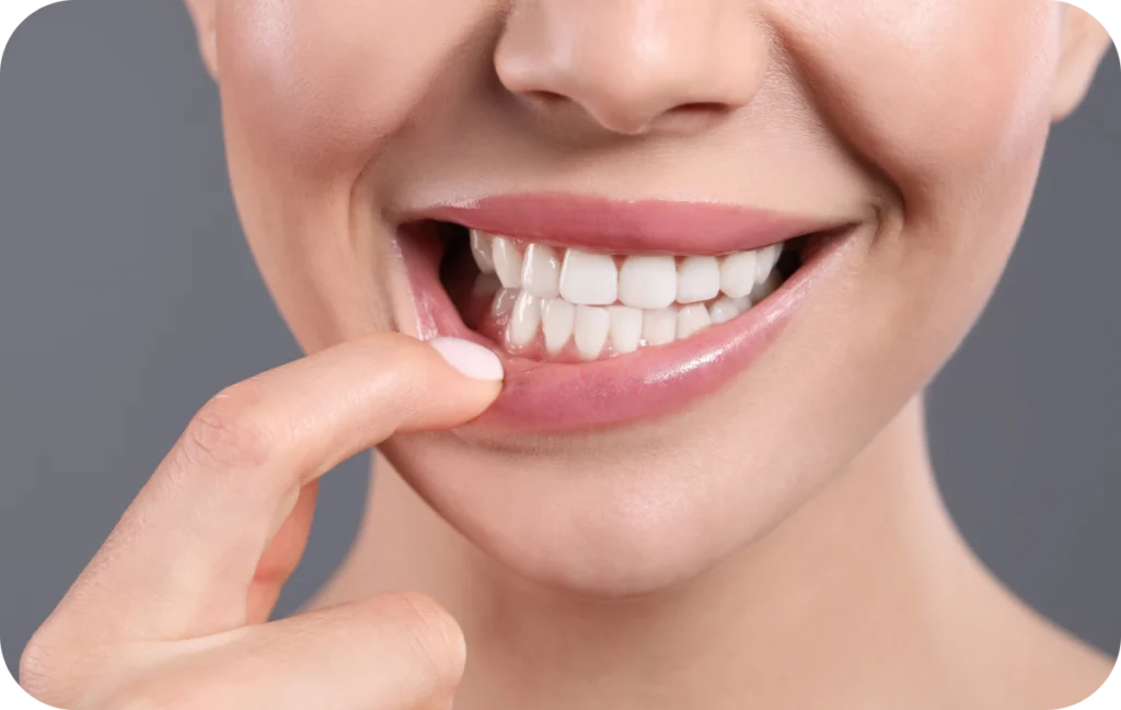 dentisterie esthetique equilibre facial villeneuve d ascq dentisterie esthetique equilibre facial villeneuve d ascq Soins des gencives Chirurgiens-dentistes | Villeneuve d’Ascq près de Lille