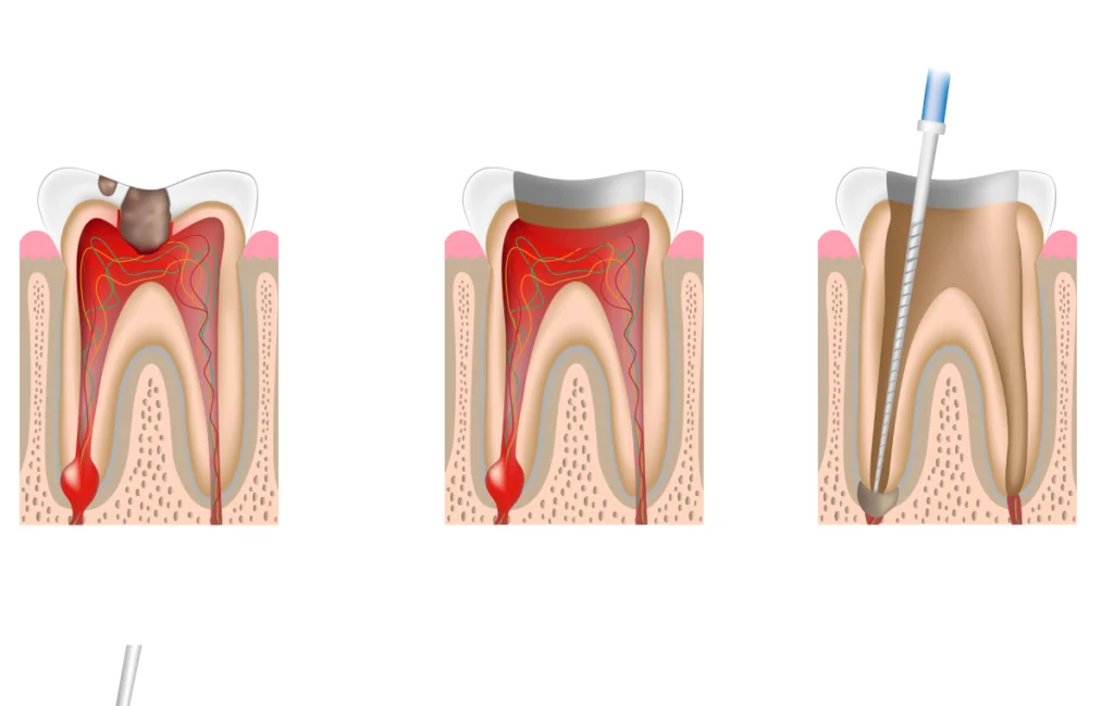 endodontie dentaire villeneuve d ascq Omnipratique Chirurgiens-dentistes | Villeneuve d’Ascq près de Lille