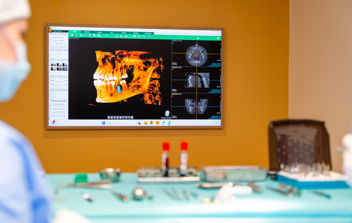 implants dentaires remplacement dents villeneuve d ascq Implants dentaires : les bonnes pratiques Chirurgiens-dentistes | Villeneuve d’Ascq près de Lille