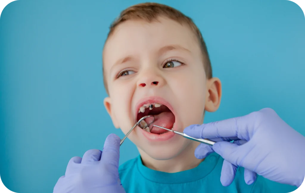 pedodontie prevention caries infantiles villeneuve d ascq pedodontie prevention caries infantiles villeneuve d ascq Pédodontie Chirurgiens-dentistes | Villeneuve d’Ascq près de Lille