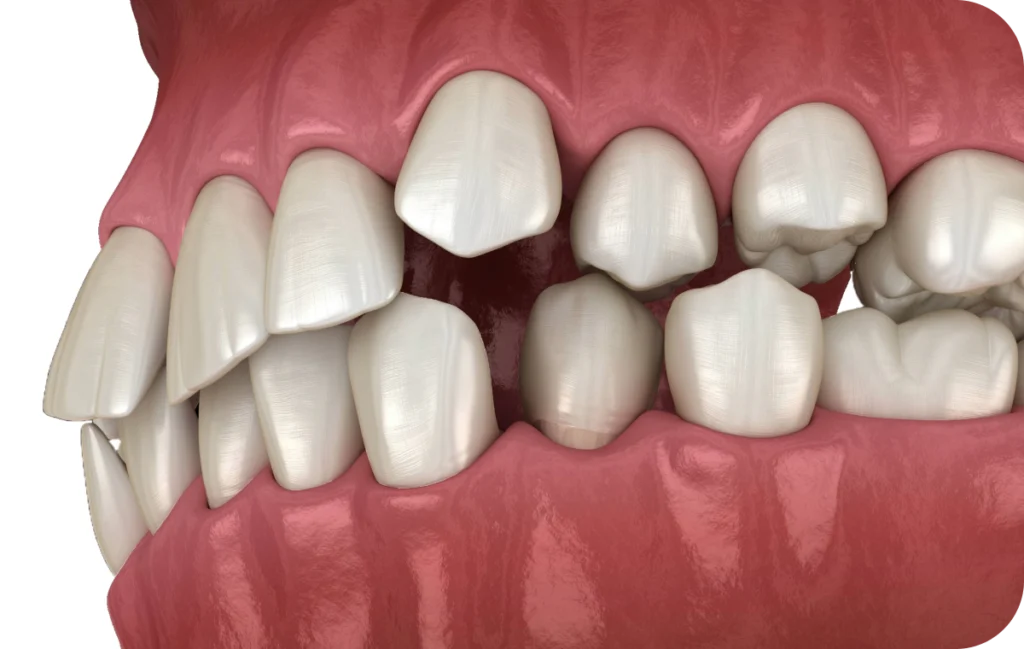 soins gencives hygiene buccale villeneuve d ascq soins gencives hygiene buccale villeneuve d ascq Occlusodontie Chirurgiens-dentistes | Villeneuve d’Ascq près de Lille